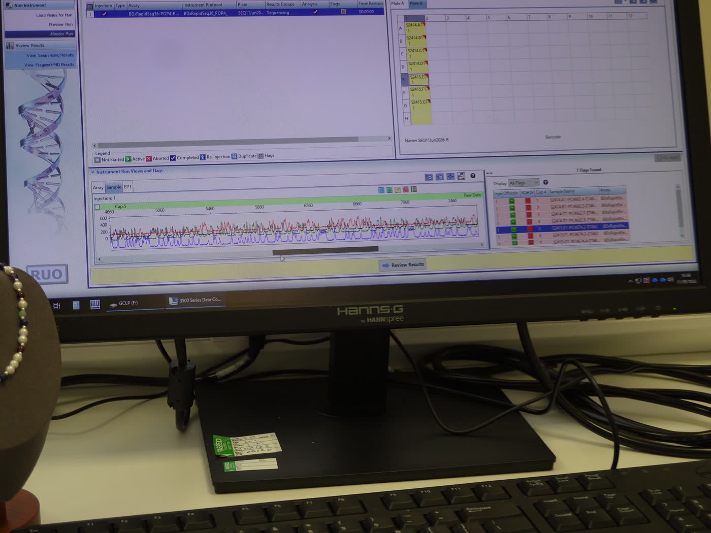 A DNA profile read on the laboratory screen