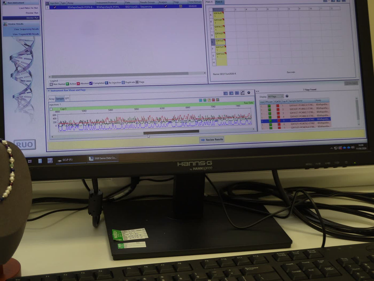 A DNA profile read on the laboratory screen